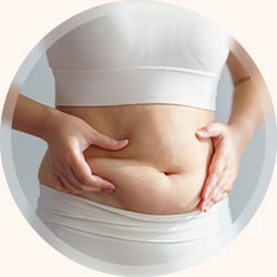 脂肪のもたつきやセルライト