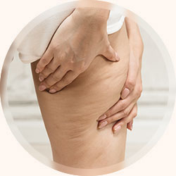 下半身のむくみやハリ不足