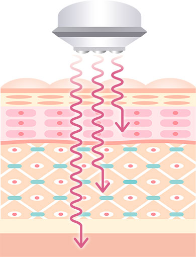 効果のイメージ