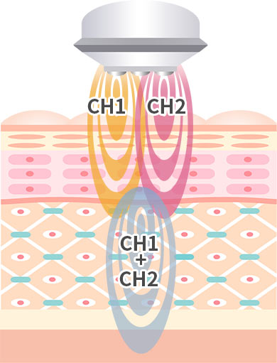 効果のイメージ