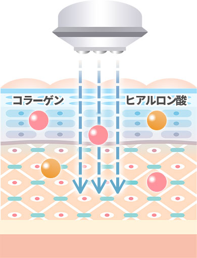 効果のイメージ